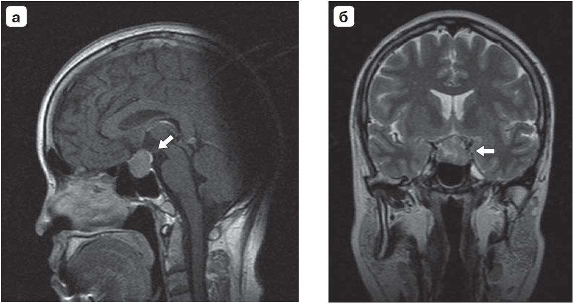 Устройство схема магнитно резонансного томографа. Магнитно-резонансная томография подготовка пациента. Устройство схема магнитно резонансного томографа. Обследование на томографе. 5 t.