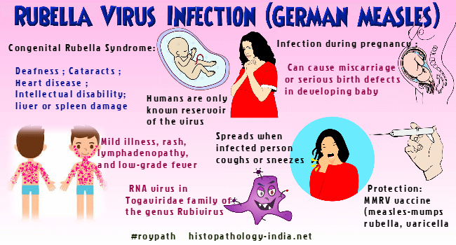 Rubella virus что означает