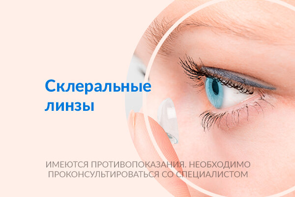 Склеральные линзы
