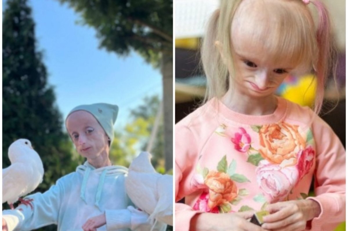 Девочки-эльфы. Как живут новосибирские дети с редкой болезнью ...