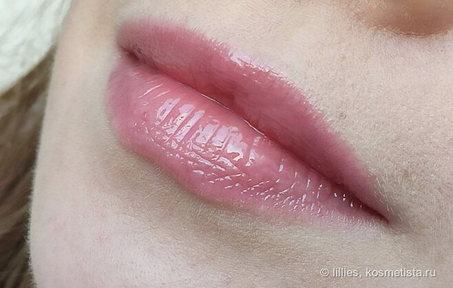 Гранулематозный хейлит. Здоровые губы. Па губа. Гиповитаминозный хейлит. Красивые губы девушек.