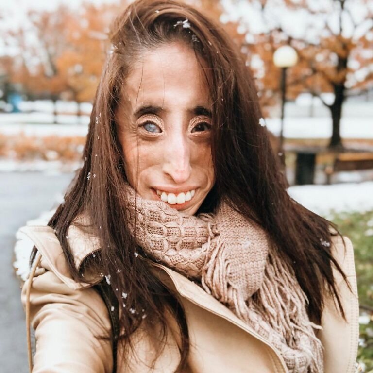 Линдси лохан конопушки. Красивые и некрасивые люди сравнение. Несколько некрасивый. Две некрасивые девушки. Некрасивый парень и красавица.