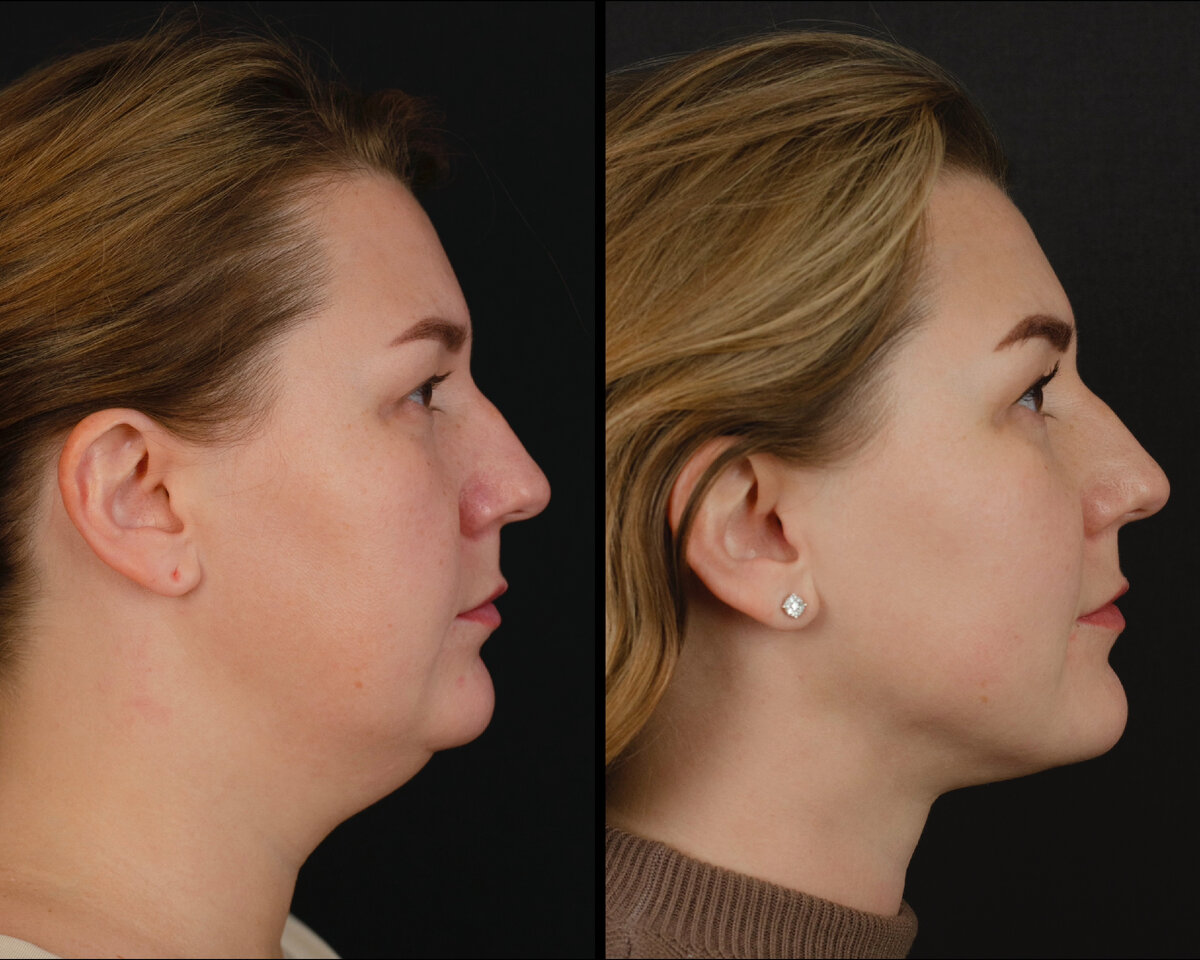 минасян хирург пластический