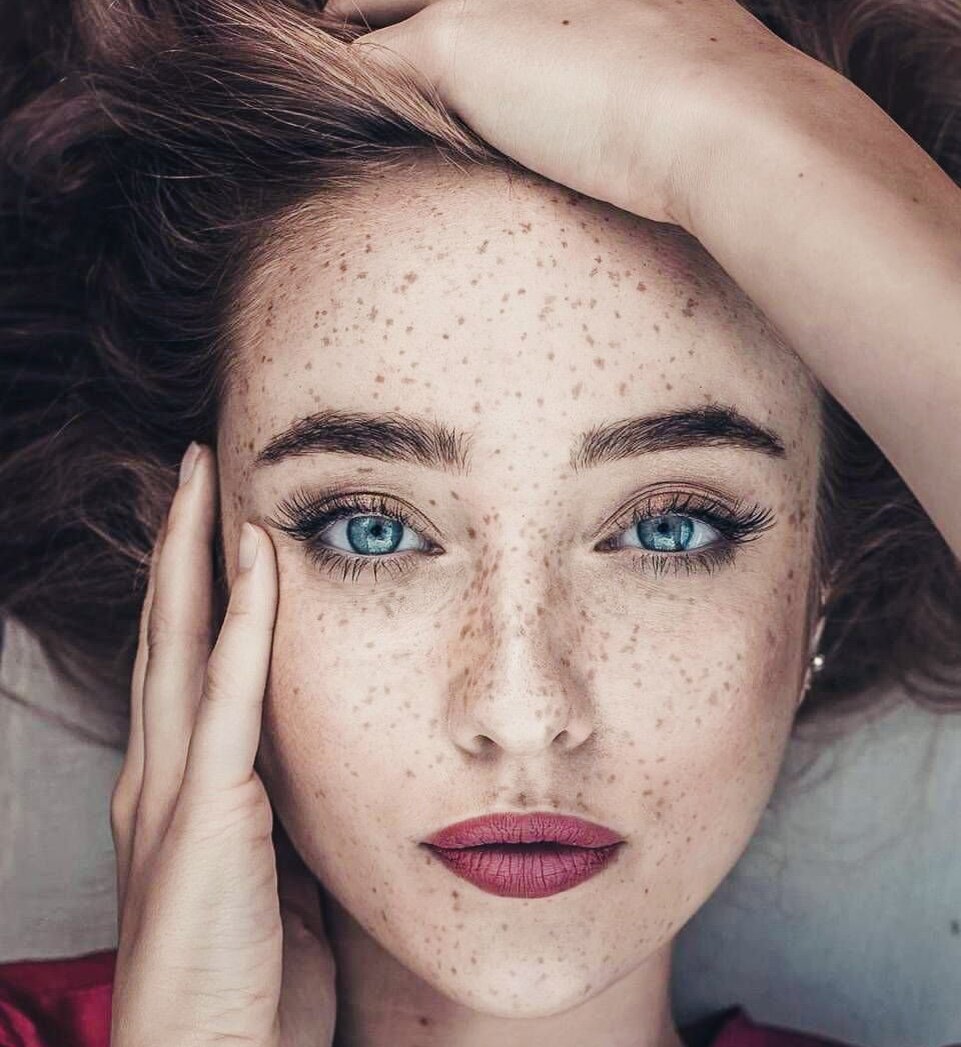 Веснушки и пятнышки витилиго — это тоже отметки, про особую связь с огнём в прошлой жизни, в том числе про трагическую