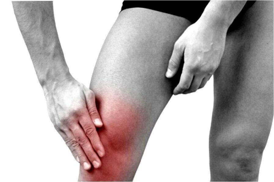 Сильно болят коленные суставы. Токсико аллергический артрит что это. Болезненность и припухлость коленного сустава.