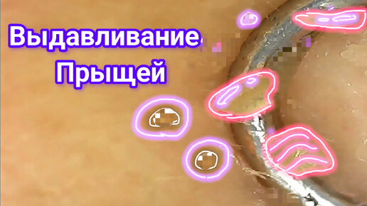 Girls already had their hands itched to squeeze them out 2023 ЖЁСТКИЙ ВКонтакте
