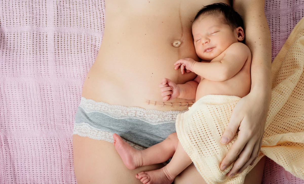 Малыш в животике. Младенец на животе у мамы. После кесарева сечения через сколько можно беременеть