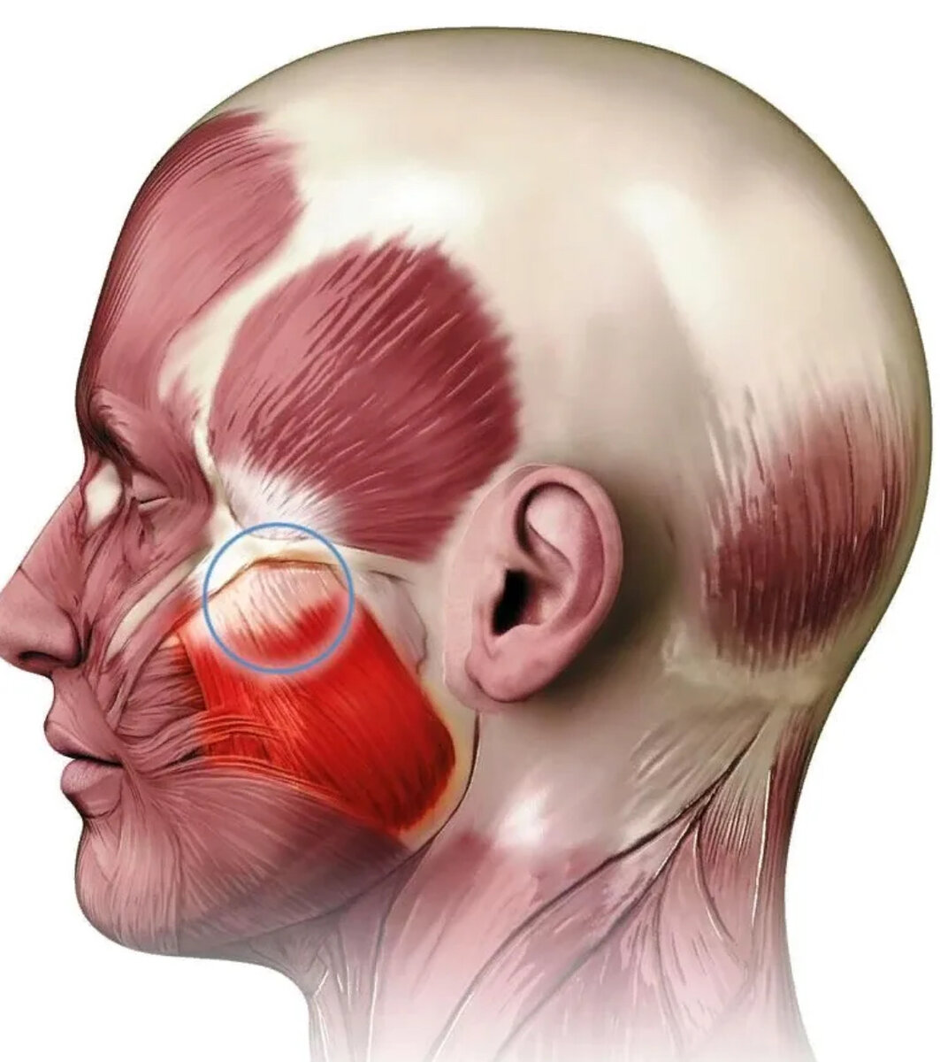 Болят жевательные мышцы. Мускулюс массетер. Гипертонус жевательных мыш. Жевательные мышцы. Челюстные мышцы.