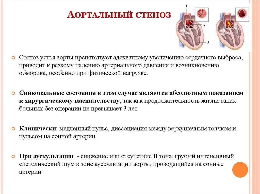 Признаки стеноза клапанов. Причины стеноза аортального клапана. Стеноз аортального клапана ад. Клинические проявления стеноза аортального клапана. Причиной приобретённого стеноза аортального клапана является.