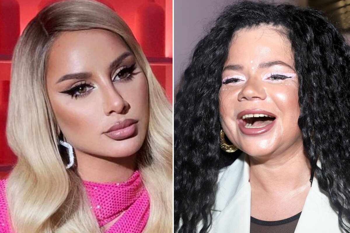 Успенская любовь блефаропластика. Валерия певица пластические операции. Алекса певица. Певицы до и после пластики. Знаменитости до и после пластики русские.