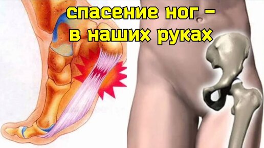 Как спасти стопы и тазобедренные суставы? Нужны упражнения для пяточных костей