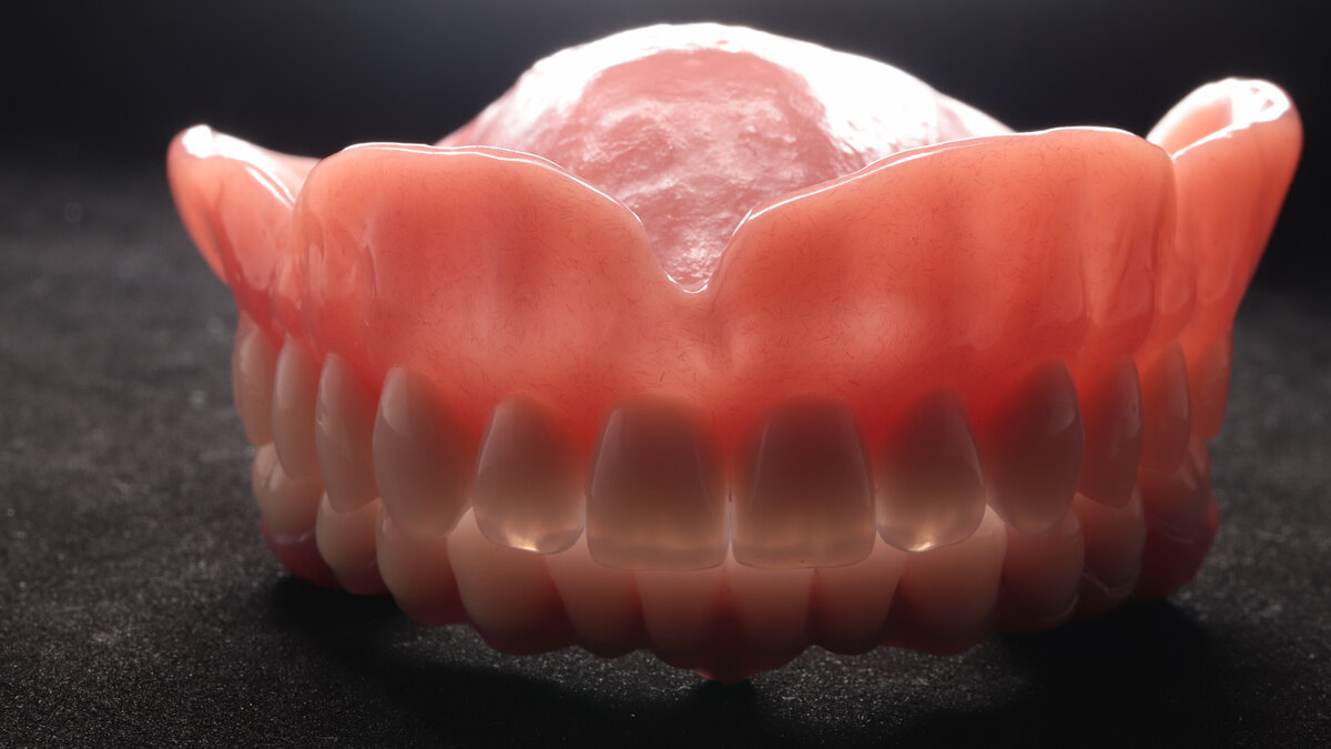 структура импланта зуба. имплант абатмент десна коронка. абсолютные противопоказания к имплантации. имплант стоматология строение. имплантат абатмент коронка.