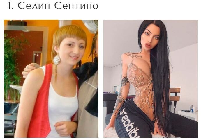 Сделала пластическую операцию и изменилась до неузнаваемости. Сделала пластическую операцию и изменилась до неузнаваемости