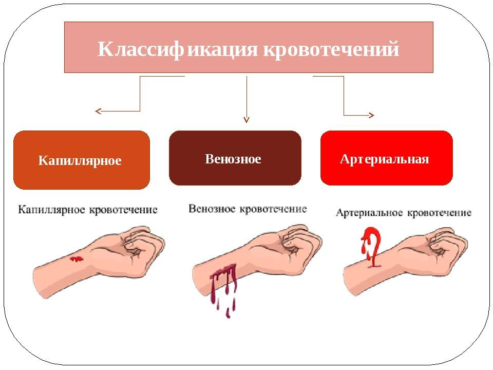 Кровотечения делятся на