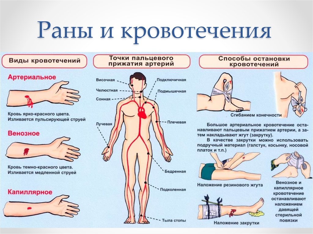 Повреждение мелких артерий кистей и стоп