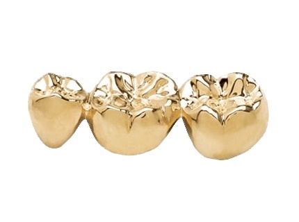 Что такое стоматологическое золото?