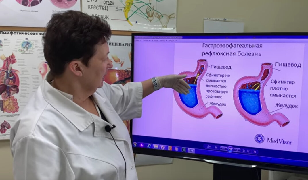 Желудочно-кишечный тракт человека анатомия. Анатомия пищеварительного тракта человека. Мальабсорбция кишечника. Препарат на ко для восстановления желудочного. Поверхностный проксимальный дуоденит.