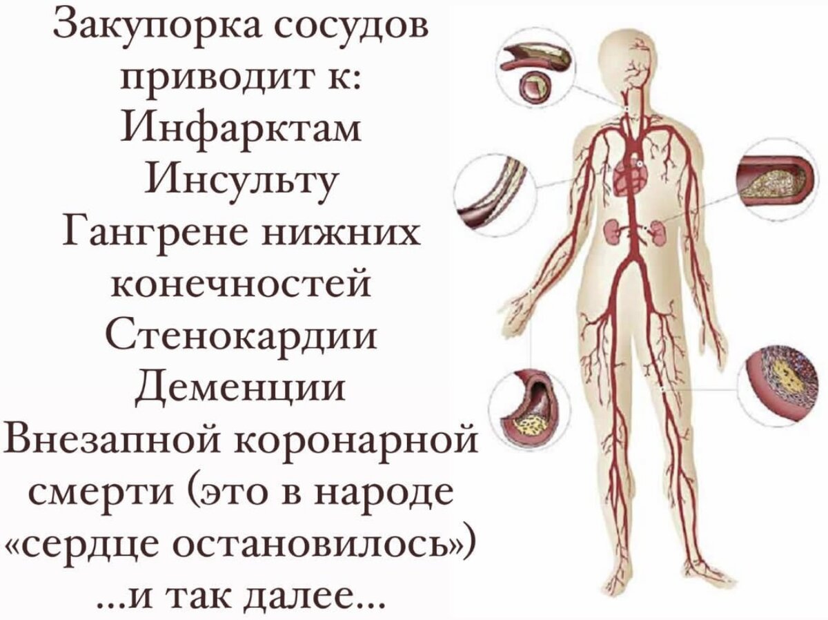 Первая помощь при повышенном артериальном давлении