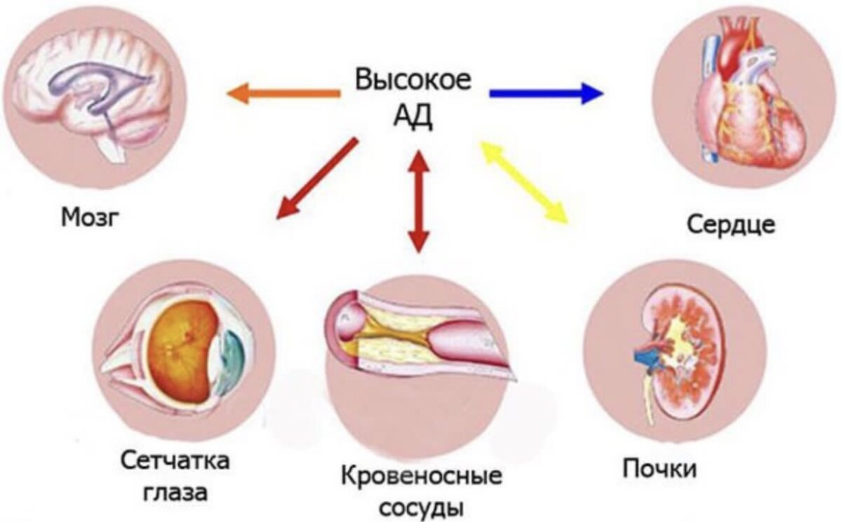 Органы мишени при гипертонической