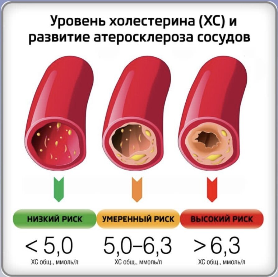 Норм ем