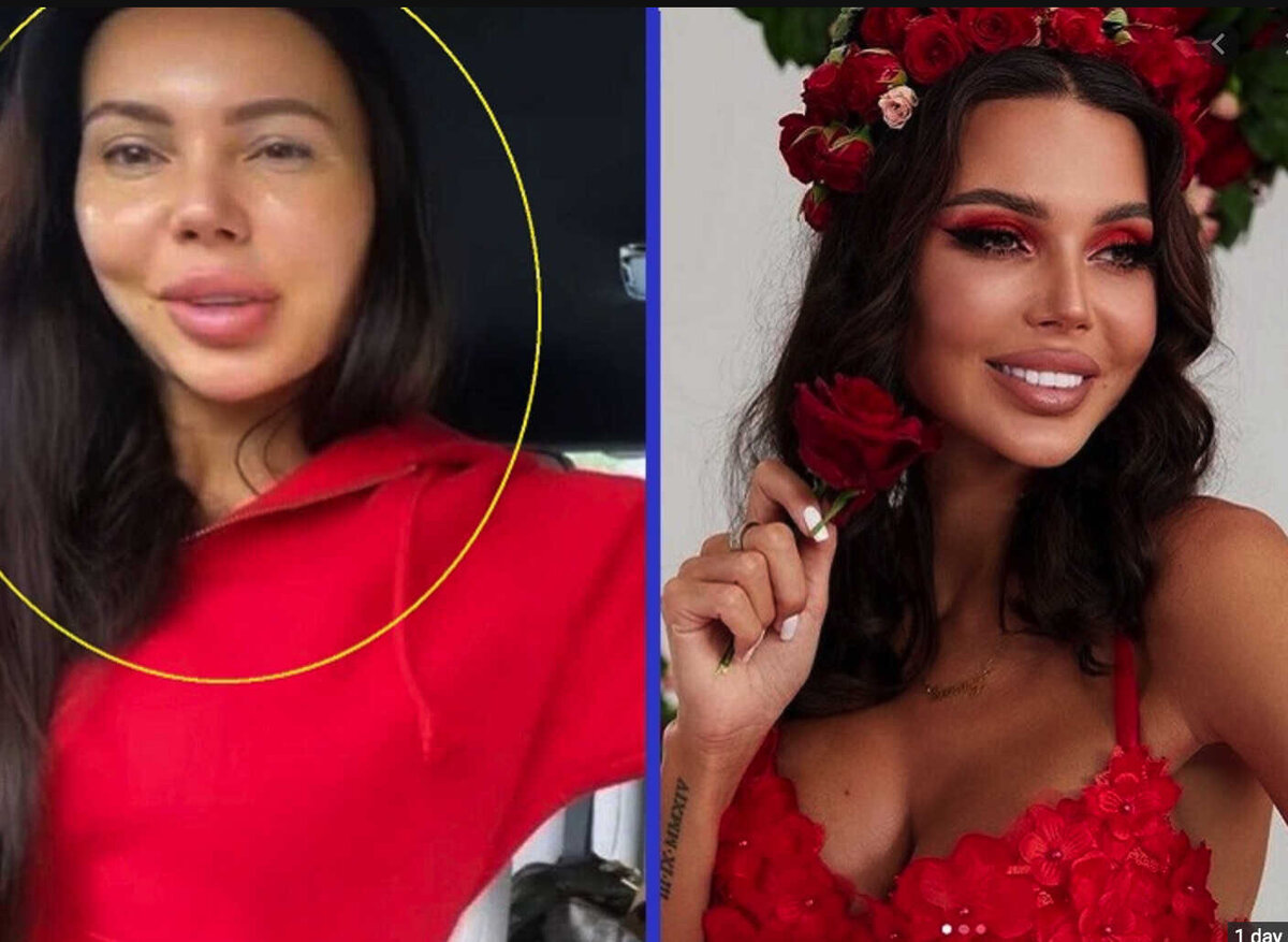 Фото жены джигана до и после Не все золото, что блестит! 5 российских звезд, которые в жизни далеки от идеала