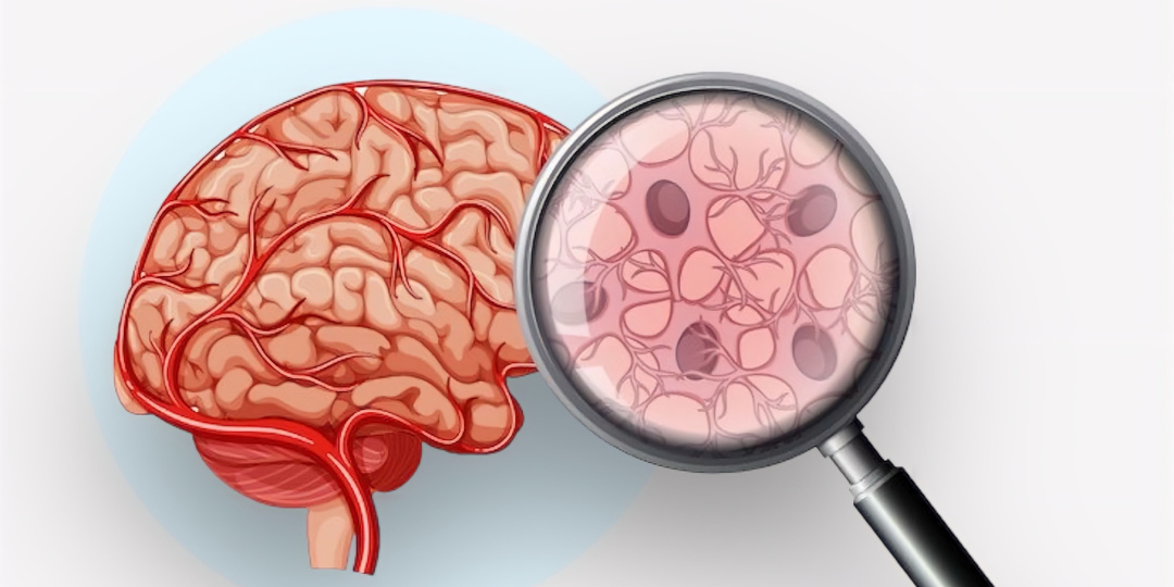 Как улучшить кровообращение мозга: Полезные продукты и необходимые действия от невролога.