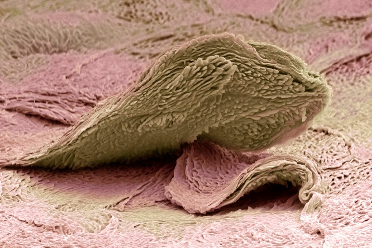 кожа человека