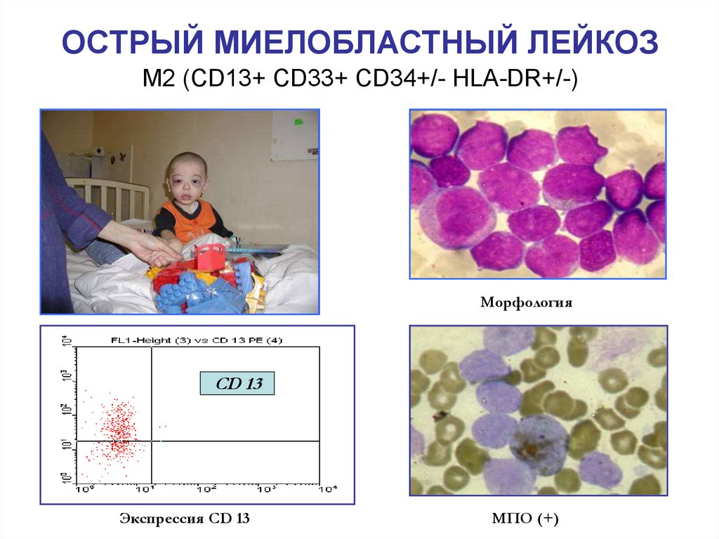 Мягких где