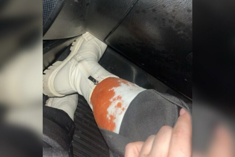    В Бузулуке бродячая собака напала на жительницу Казани Марина Шарт