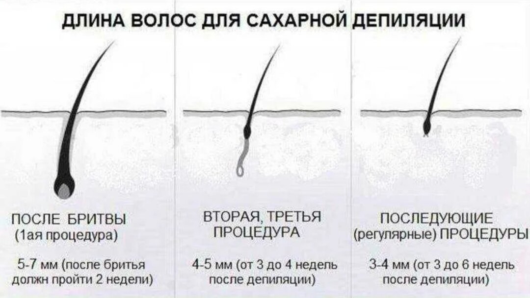 После шугаринга через сколько вырастают. Схема роста волос. Длина волосков для депиляции. Схемы роста волос для депиляции.