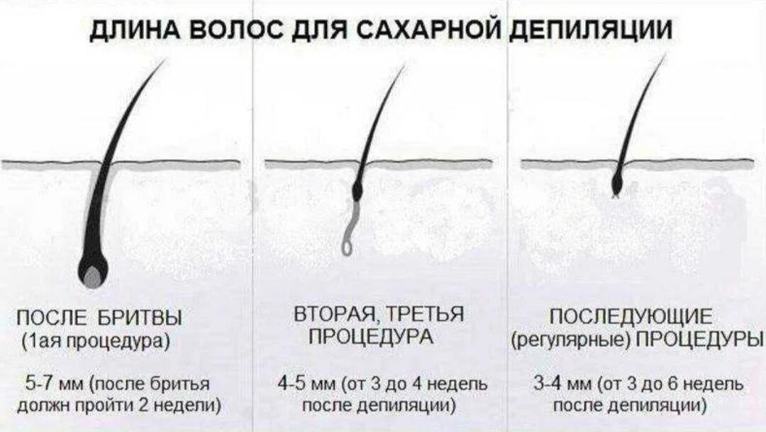 Отрастить волосы для депиляции. Схема роста волос. Длина волосков для депиляции. Схемы роста волос для депиляции.