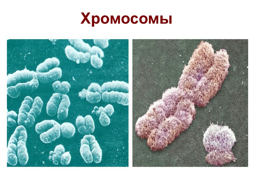Как выглядит хромосома человека