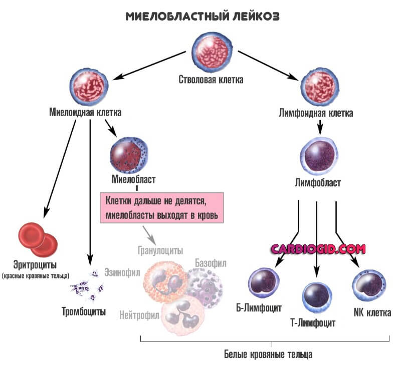 Лейкоз характеризуется. Острый миелоидный лейкоз. Острые миелоидные лейкозы проявления. Острый миелоидный лейкоз картина крови. Острый миелобластный лейкоз картина крови этиология патогенез.