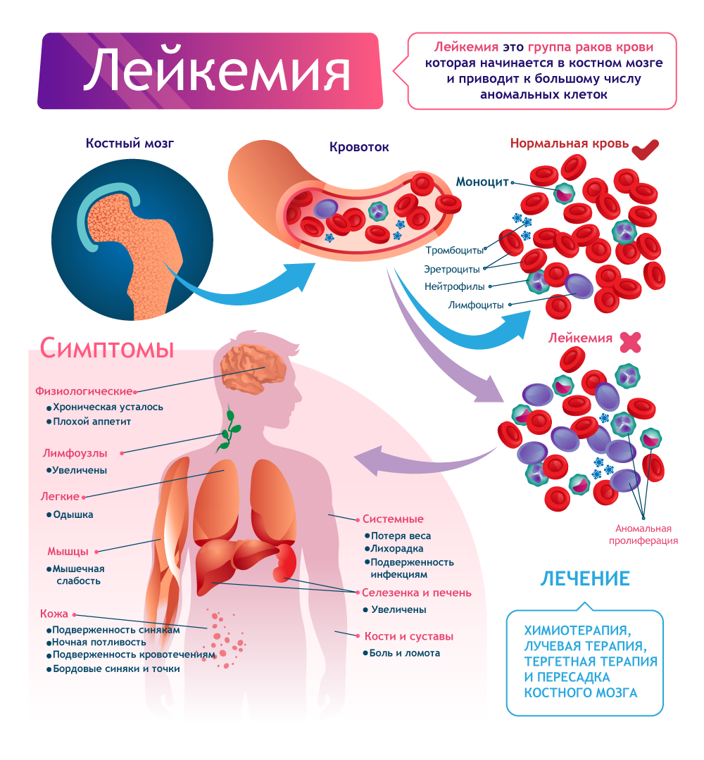 Как выглядит рак крови
