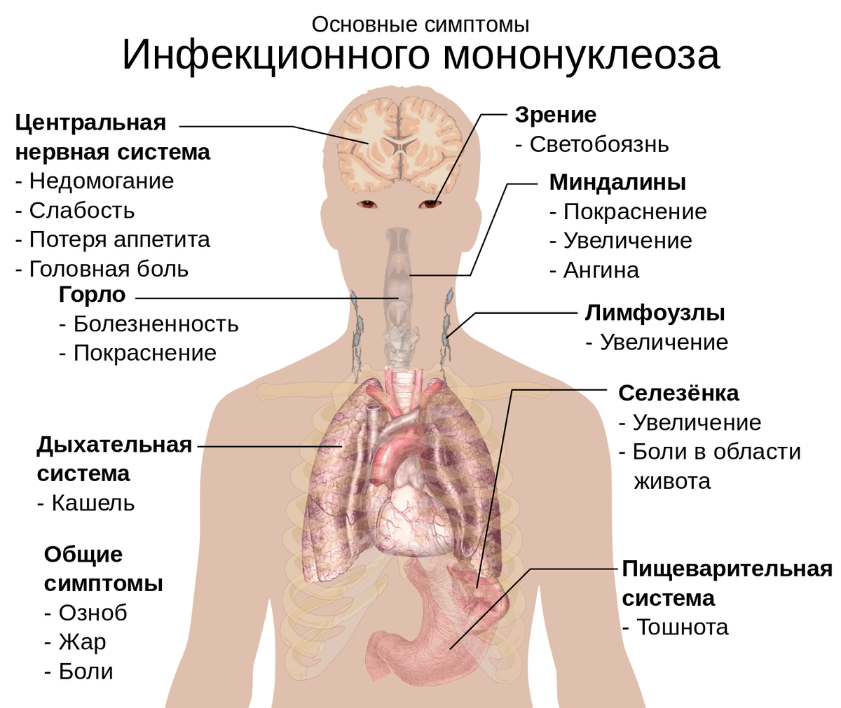 Инфекционный мононуклеоз у детей: чем отличается от ангины и почему нельзя  антибиотики? | О детском здоровье: с врачебного на родительский | Дзен