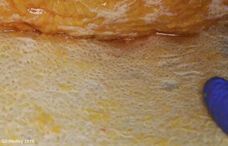 Наша кожа изнутри