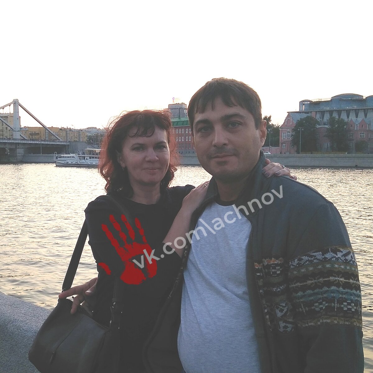 Пирогово хирург пластический. За каждую операцию 1. За каждую операцию 1. Операционная медицинская сестра. Операционная в хирургии.