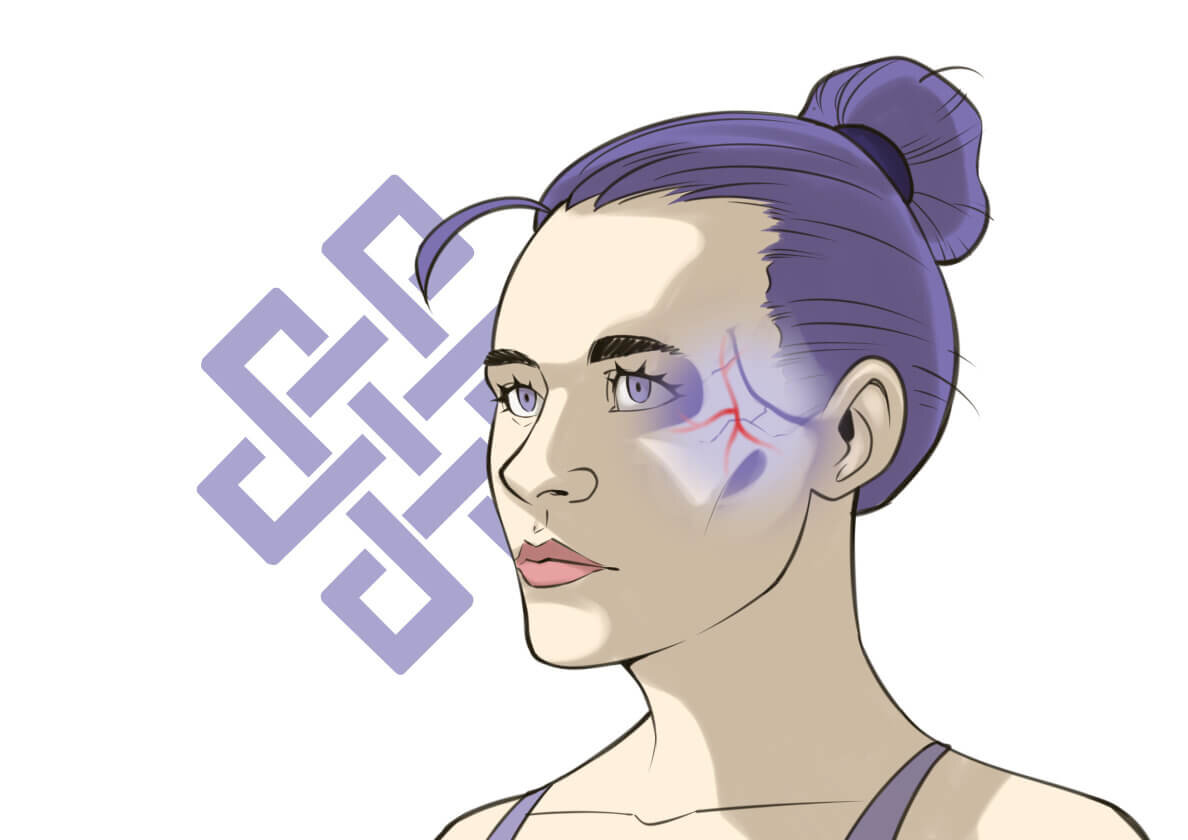 Воспаление тройничного нерва 