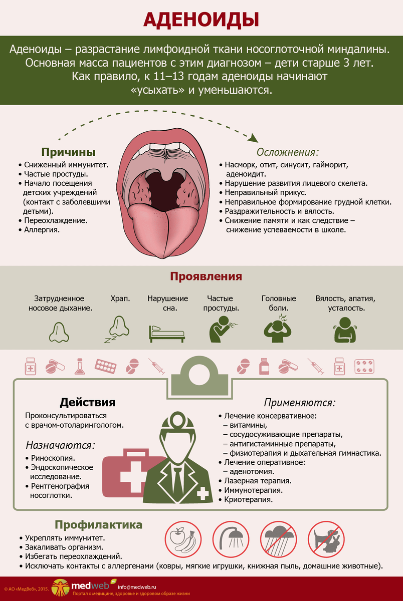 Как мы перенесли операцию по удалению аденоидов | Быт многодетной  удалёнщицы | Дзен