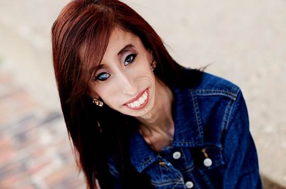 Lizzie t. Элизабет «Лиззи» Веласкес. Лиззи Веласкес Lizzie Velasquez.
