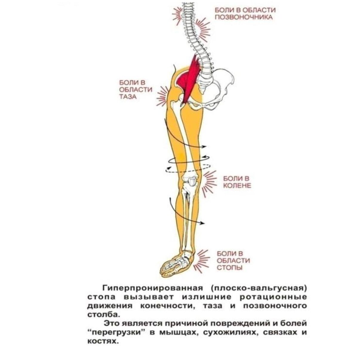 Позвоночник ноги. Болит весь таз. Перекос таза. Хроническая тазовая боль клинические рекомендации. Болит весь таз.