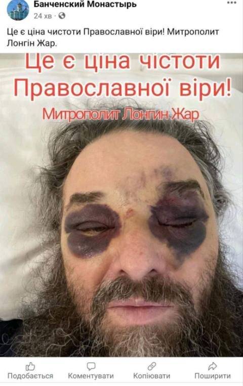    На Украине жестоко избили православного архиерея, а из Эстонии выгнали митрополита ЭПЦ