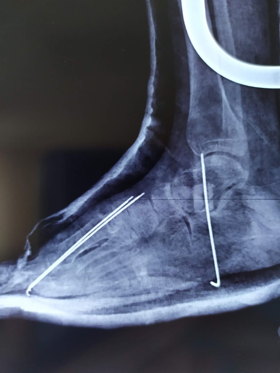 детская травматологическая больница. детская травматология 3. детская травматология 3. врач ортопед детский. детский массаж девочке.