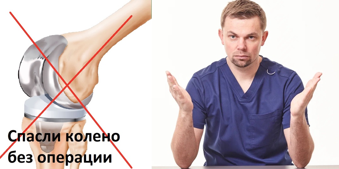 Правильное лечение — ключ к спасению сустава. Невыдуманная история.