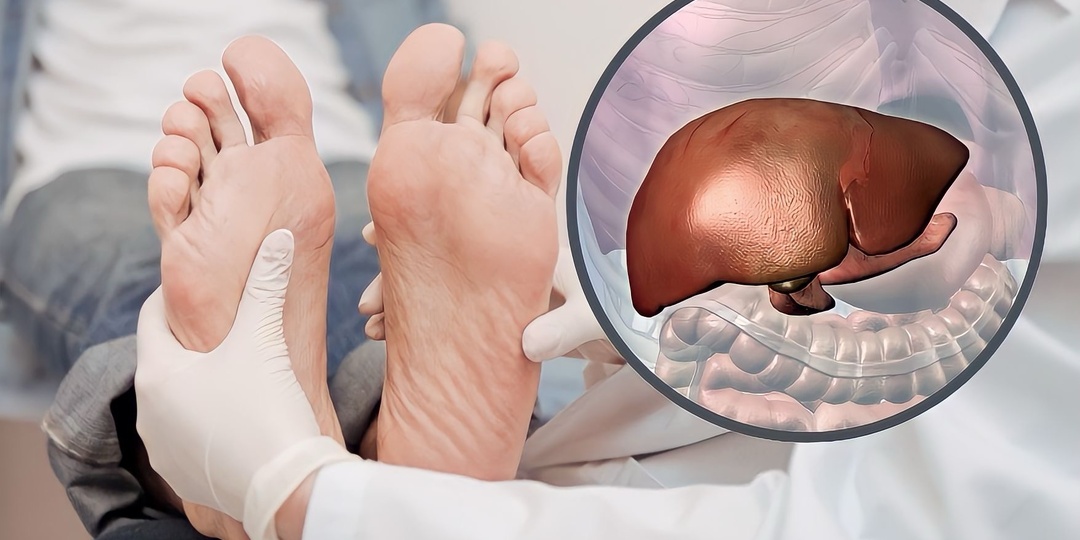 Как определить состояние печени по ногам: отеки и другие признаки, на которые следует обратить внимание