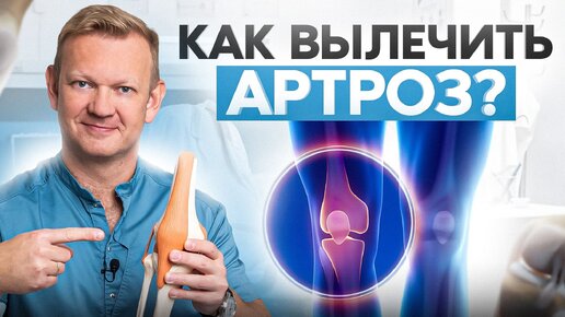 Download Video: Лечение артроза дома: 7 проверенных методов восстановления коленей! Даже капустой можно?