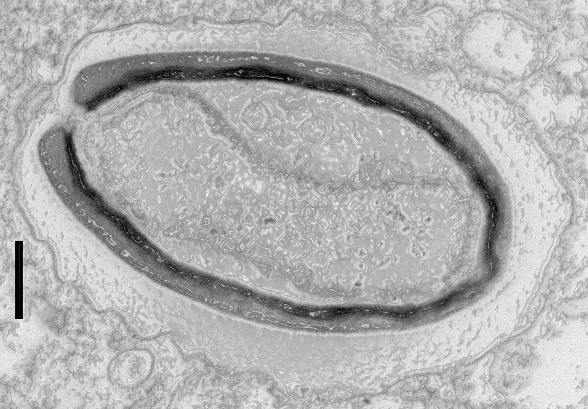 Pandoravirus quercus, обнаруженный исследователями в Марселе. Масштабная линейка слева — 100 нанометров. 