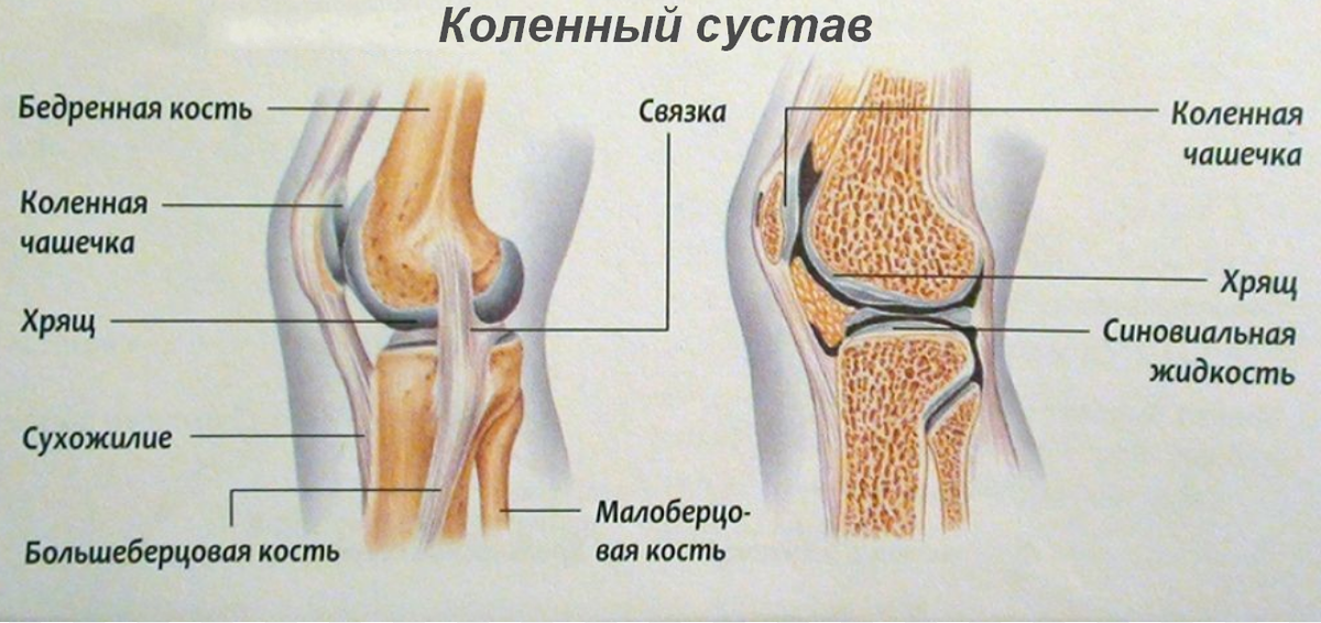 Как выглядит колено с жидкостью внутри Коленный сустав