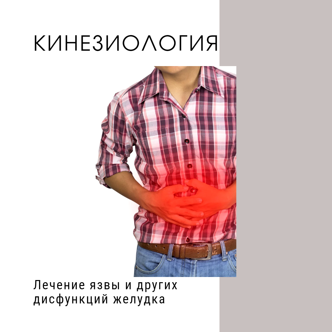 Лечение язвы и других дисфункций желудка методом прикладной кинезиологии и висцеральной терапии. 

Язва желудка, также как и другие дисфункции, например, нарушение уровня кислотности в желудке, могут вызываться разными причинами. Но все они в итоге обычно связаны с нарушением функции кровоснабжения стенок желудка. Причин этого может быть несколько. 
Например даже при одноразовом сильном переедании на новогодние праздники расположение желудка может измениться и даже привести к скользящий грыже пищевода. 
А ещё одной причиной может стать дисфункция (неправильное расположение или натяжение) печёночно желудочной связки. 

Все эти дисфункции приводят к нарушению кровоснабжения стенок желудка. 

Если пациент на фоне такой дисфункции испытал ещё и стресс, то гладкая мускулатура желудка спазмируется, и желудок становится очень плотный ("деревянный" ). 
Всё это может привести к периодическим забросам желчи в желудок, что повышает риск язвы.