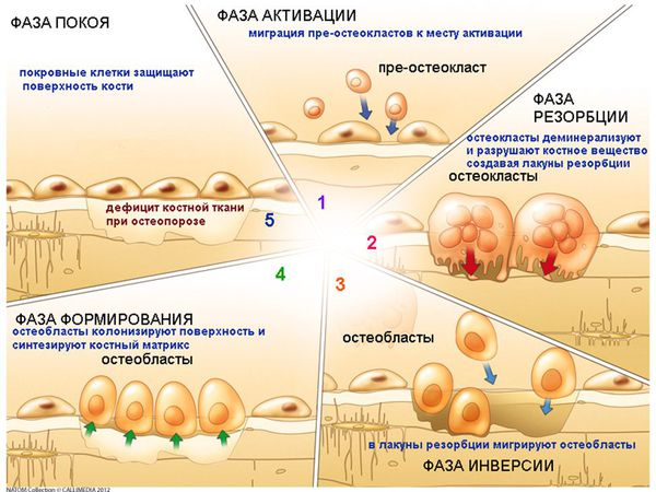 Регуляция костной ткани. Стадии ремоделирования костной ткани. Ремоделирование костной ткани резорбция. Ремоделирование костной ткани схема. Резорбция костной ткани схема.